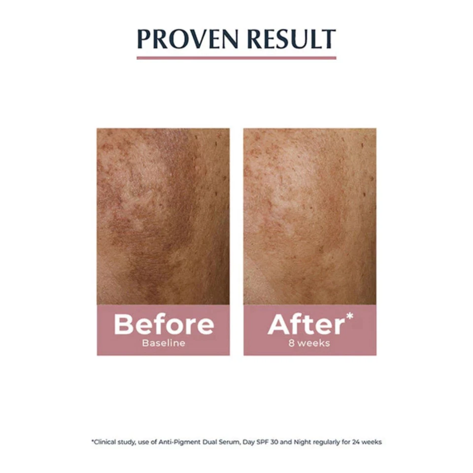 Eucerin Líquido Iluminador Impecable de Noche 50 ml - Crema de Tiamidol para Tono Uniforme Foto 4 de 4