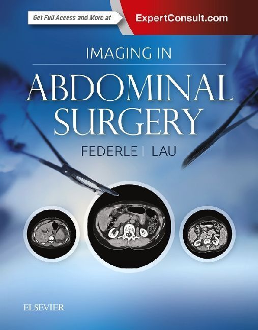 Thumbnail - Imaging In Abdominal Surgery | Michael P Federle, James Lau | 2018
