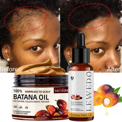 SAUVASINE 5/3x Batana Oil Conditioner Serum for Hair Growth Healthier Thicker Fuller Hair