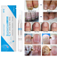 thumbnail 2 - Nail Fungal Treatment Pen Anti Fungus Infection Biological Repairs Solution Care
