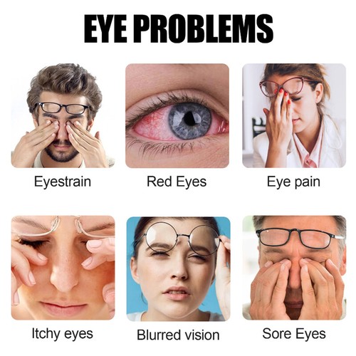 Lutein Ester Capsules 120mg Zeaxanthin (Marigold Extract) Strongest EYE HEALTH - Picture 3 of 10