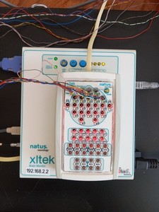 Natus Xltek Brain Monitor / Connex EEG System Neuroworks 8.5 32ch Video Masimo