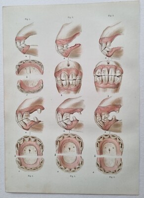 Antiker ANATOMIEABSCHNITT PFERDEZÄHNE Druck mit Index Chromo von 1880