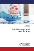 Implant Supported Overdenture Kapil Singla