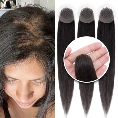 RICH-CHOICES Cover-up 100% Remy Human Hair Patches No Surgical Solution Alopecia Hand-tied UK