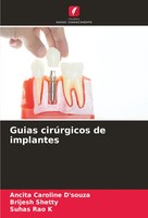 Guias CirúRgicos De Implantes Ancita Caroline D'souza (U. A.) Taschenbuch 2024