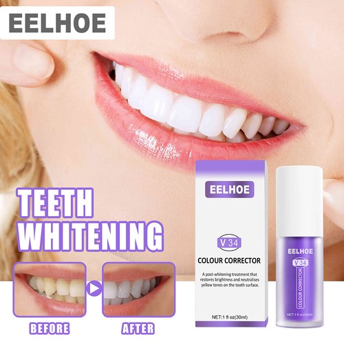 v34 whitening