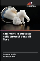 Poonam Malik (U. A.) | Fallimenti E Successi Nelle Protesi Parziali Fisse | Buch