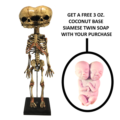Aged Triclops 3 Three Eyed Siamese Twin Fetus Skeleton Medical
