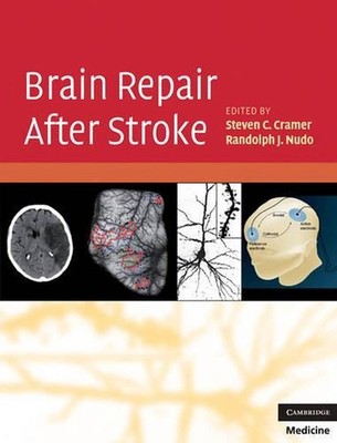 Brain Repair After Stroke by Steven C. Cramer (English) Hardcover Book