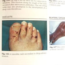 Color Atlas of Critical and Intensive Care Di...