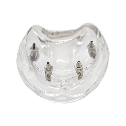 Multiple Types Dental Teeth Model Ortho Implant Practice Teaching Demo Model - Picture 267 of 276