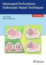 Nasoseptal Perforations: Endoscopic Repair Te...