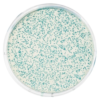 Transformation of E. coli with pGAL  (Blue Colony)