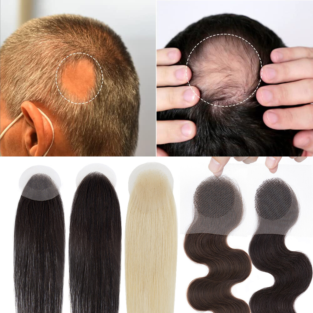 Pattern Baldness Tape In Extensions And Hair Loss Thin Skin PU