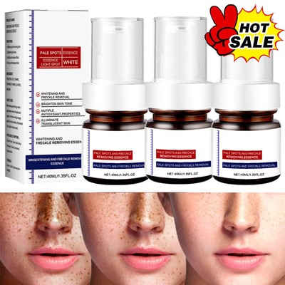 40ML White and Freckle Removing Essence --20% OFF--- 1~3PCS