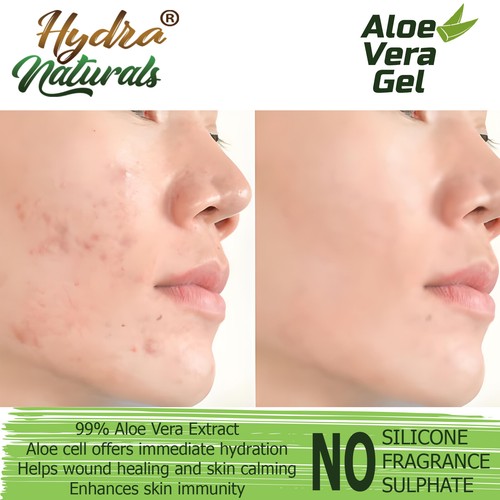 Hydra Naturals Hydro Active 99% Aloe Vera Gel Moisturiser For Dry Skin Hair 500m - Picture 3 of 11