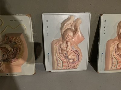 Hubbard Scientific 3D Educational Anatomy Wall Model - Birth