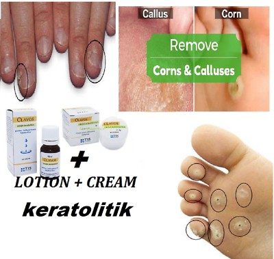 cream for hard skin on feet