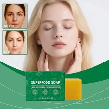 .Premium Superfood Soap Turmeric Lemon Soap Bar For Dark Spots 100g Beauty 