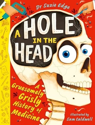 A Hole in the Head: A gruesomely grisly history of medical firsts by Suzie Edge