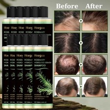 1 10 Organic Rosemary Hair Growth Shampoo with Hydrolyzed Keratin Extra Strength