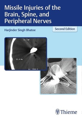 Harjinder S Bhatoe / Missile Injuries of the Brain, Spine, and ...9789388257107