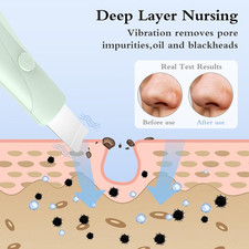 Skin Scrubber Face Spatula Skin Spatula Pore Cleaner Blackhead Remover Tools ...