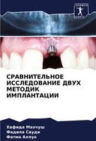 Hafida Mahchush (U. A.) | Sravnitel'noe Issledovanie Dvuh Metodik Implantacii