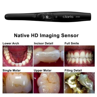 SOTA Imaging  Claris i5HD Intraoral Camera System CMOS Sensor