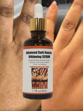 Advanced Whitening Dark Skin Knuckles Feet Knees Elbows Armpit inner Thigh Serum