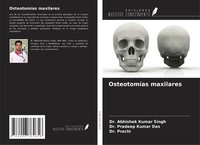 OsteotomíAs Maxilares Abhishek Kumar Singh