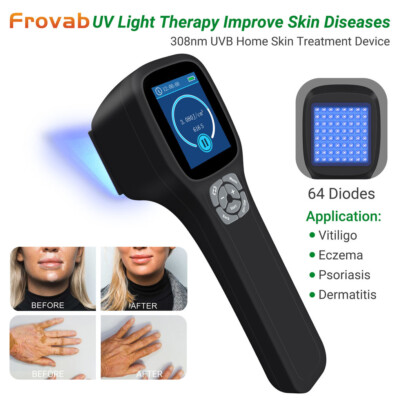 308nm Handheld Blue Light Therapy Treatment for Vitiligo Skin Disease 5-50mW/cm²