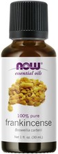 Now Foods Pure Frankincense Oil - 1 Ounce Pack of 3