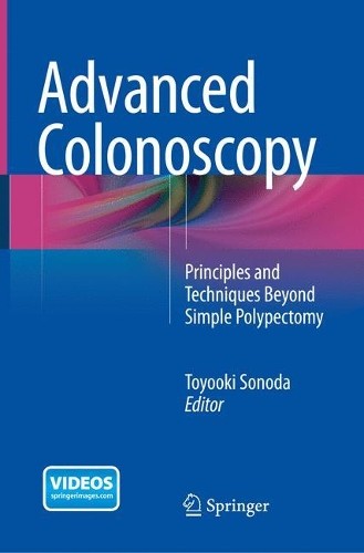 Advanced Colonoscopy - 9781493955435 - Foto 1 di 1