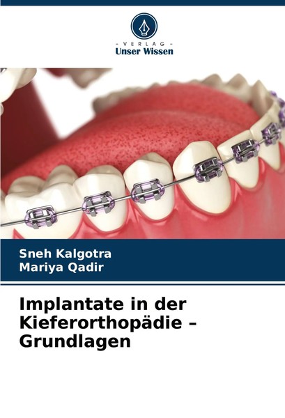 Implantate In Der KieferorthopäDie - Grundlagen Sneh Kalgotra (U. A.) Buch 2024-image