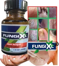 HONGO Best nail Fungal Support FAST  BEST PRODUCT 4 NAILS NEW fungi