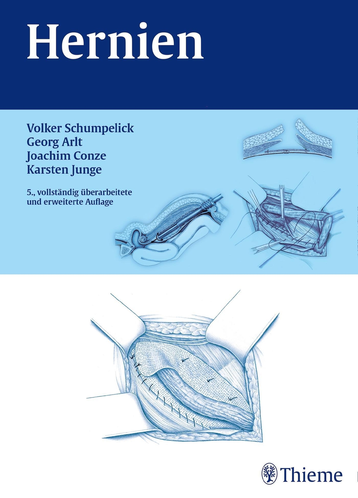 Thumbnail - Hernien | Volker Schumpelick (u. A.) | Buch | Gebunden (fh) | 384 S. |