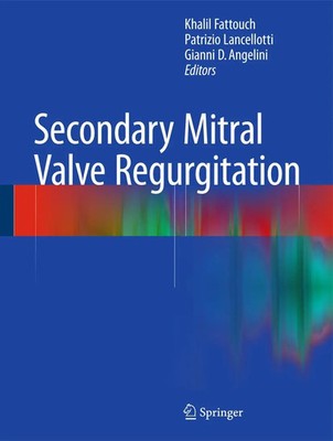 Khalil Fattouch (u. a.) | Secondary Mitral Valve Regurgitation | Buch | Englisch