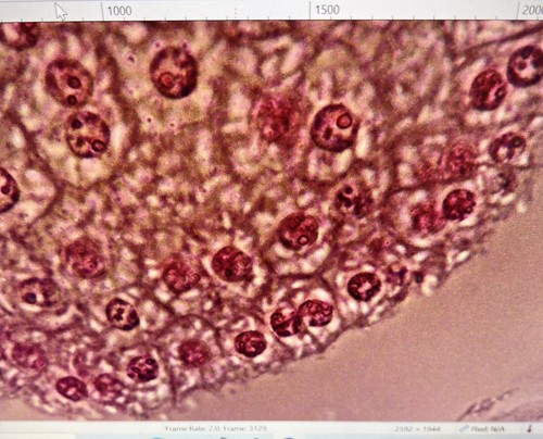 Bausch and Lomb Cambridge Leica Galen 3 Trinoc Phase Contrast Microscope - Picture 10 of 22