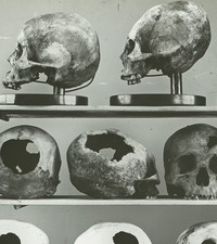 Magisches Laternendia - Foto alter menschlicher Schädel im Museum - Unid. Halterung.