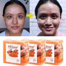 3pc Tumeric Soap Skin Whitening Dark Spots lightening Acne Brightening Turmeric