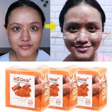3pc Tumeric Soap Skin Whitening Dark Spots lightening Acne Brightening Turmeric