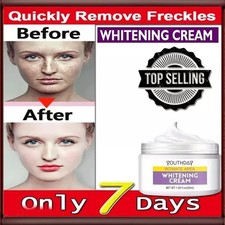Whitening Cream Remove Dark Spot, Anti Freckle and Aging Cream Fade Pigmentation