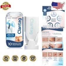Skin Tag Remover Kit - -Cleared - Gentle Freeze-Off - 10 Treatments