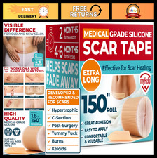 Medical Grade Silicone Scar Tape 1.6"x150" - Keloid C-Section Treatment - Reus