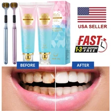 Niacinamide Whitening Toothpaste,Natural Niacinamide Toothpaste,Teeth Whitening