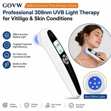 308nm Excimer UVB Phototherapy Light Clinical Grade Targeted Skin Care Device