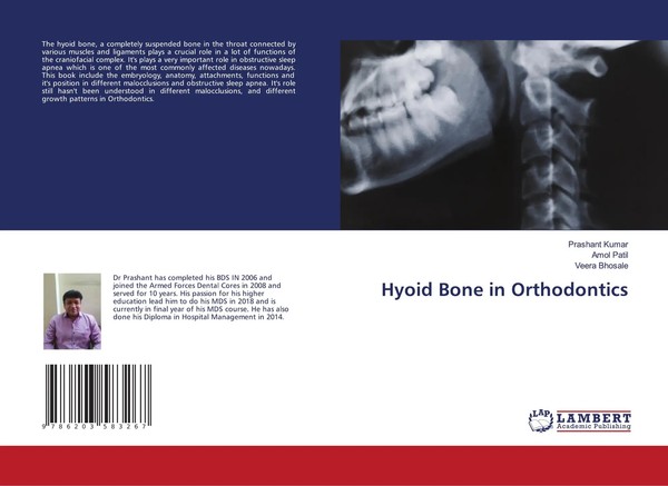 Prashant Kumar (U. A.) | Hyoid Bone In Orthodontics | Taschenbuch | Englisch-image