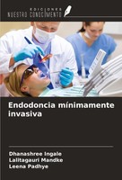 Endodoncia MíNimamente Invasiva Dhanashree Ingale